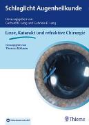 Vorderes Coverbild Schlaglicht Augenheilkunde: Linse, Katarakt und refraktive Chirurgie